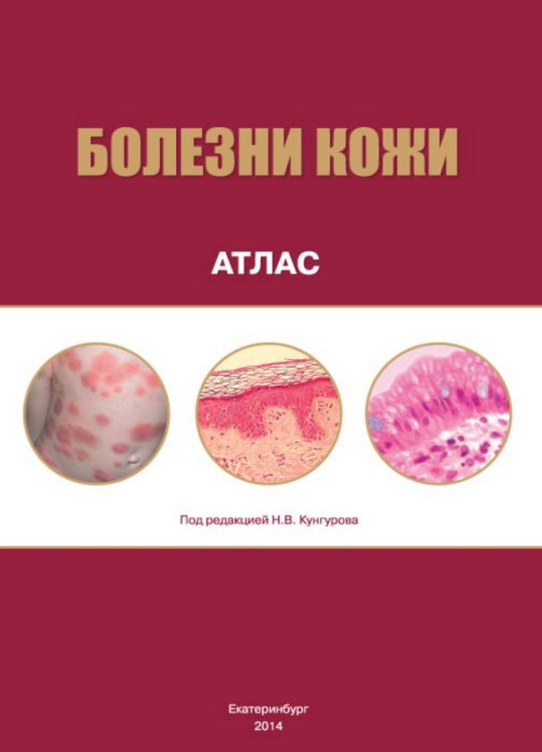 Diseases of the skin. Atlas.